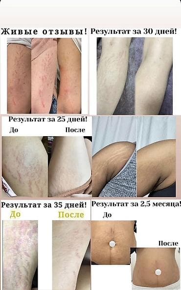 epix pro gen 2: Для улучшения кожи, Универсальный, Южная Корея, Капсулы, Новый — 5