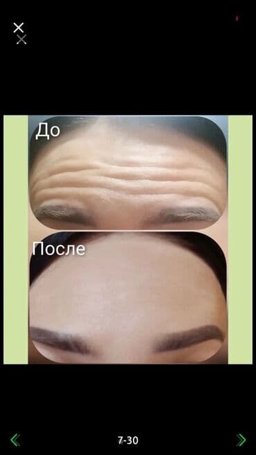 сапоги зимние женские натуральная кожа натуральный мех распродажа: Косметология, Ботокс, Биоревитализация, Ботулинотерапия, Консультация, Гипоаллергенные материалы, Сертифицированный косметолог — 2