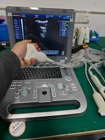 Ингаляторы, небулайзеры: Портативный ультразвуковой аппарат SUNBRIGHT (ноутбучный форм‑фактор) — 1