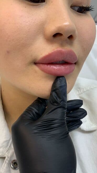 слива ферментированная капсула для похудения отзывы: Косметология, Биоревитализация, Контурное моделирование, Лечение угревой болезни, Сертифицированный косметолог — 6