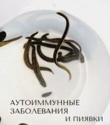 корм для форели купить: Пиявки медицинские. Сүлүк сатылат.Продаются пиявки . Активные. Размеры — 1