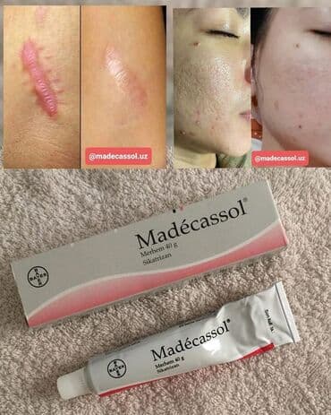 кардиомарин для варикоза: Мадекассол Madecassol Показания к применению рубцовые изменения кожи — 1