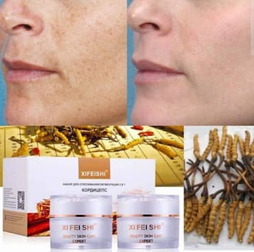 Ты знаешь, что осень-очень подходящее время для отбеливания at lalafo.kg Ты знаешь, что осень-очень подходящее время для отбеливания