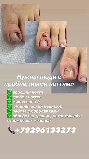 врач лор: Подологические услуги для проблемных ногтей и стоп - Коррекция — 1