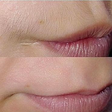 пилинг для мужчин: Восковая депиляция для женщин и мужчин Подмышки - 500 сом — 8