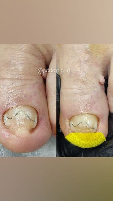 сколько стоит обучение на мастера маникюра: Коррекция вросших ногтей, Маникюр, Педикюр, Услуги подолога, Консультация, Одноразовые расходные материалы — 11