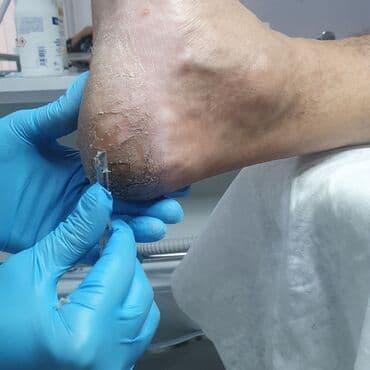 сколько стоит обучение на мастера маникюра: Коррекция вросших ногтей, Маникюр, Педикюр, Услуги подолога, Консультация — 18