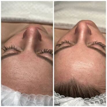 частный роддом бишкек цены: Косметология, Пилинг, Ботулинотерапия, Плазмолифтинг, Консультация, Требуются модели, Сертифицированный косметолог — 8