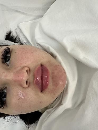 а32 128: Контурная пластика губ
Акция ‼️
Писать в вотс ап — 1