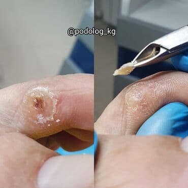 сколько стоит обучение на мастера маникюра: Коррекция вросших ногтей, Маникюр, Педикюр, Услуги подолога, Консультация — 16