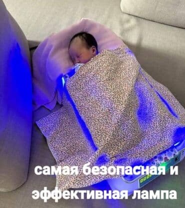 аренда лампа для лечения желтухи новорожденных: Фотолампа от желтухи желтушка Кувез, Арка Палатка от 350-400-500 — 2