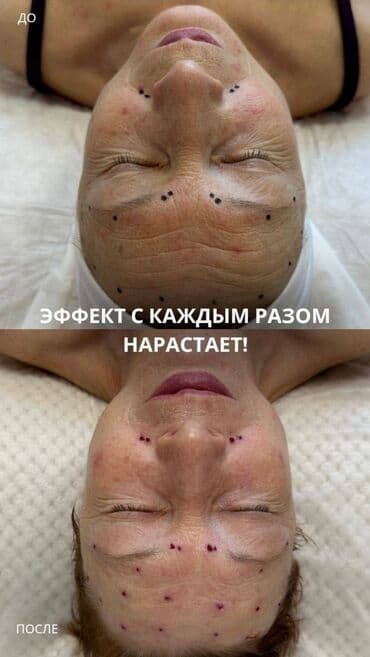 медицинский массаж курсы: Косметология, Демодекоз, Контурное моделирование, Лечение угревой болезни, Консультация, Гипоаллергенные материалы, Сертифицированный косметолог — 18