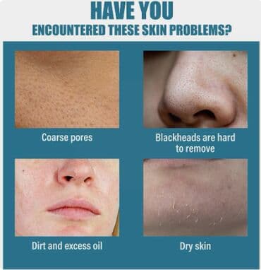 прыщей: ❄️ США СЫВОРОТКА ДЛЯ КОЖИ ОТБЕЛИВАНИЕ цена-450сом\флак-розниц — 6