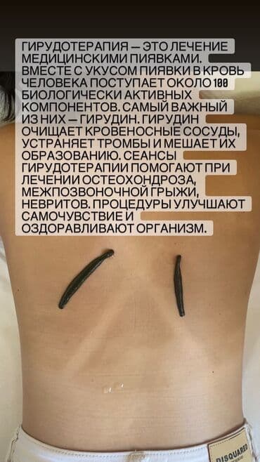самый лучший гинеколог в бишкеке: Клиника, Дарыгерлер | Гирудотерапевт | Консультация, Диагностика, Пиявкалар менен дарылоо — 7