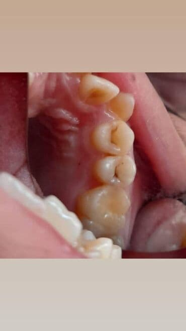 лучший детский стоматолог бишкек: Стоматолог Бишкек. Профессиональная чистка. Лечение кариеса и его — 2