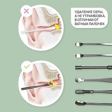 Медтовары: Многоразовый металлический набор инструментов для чистки ушей, ушной — 2