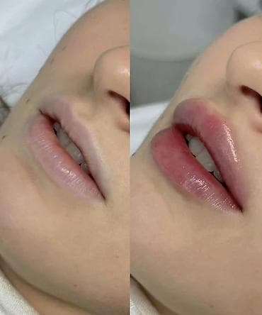 Нужна модель на увеличение губ Цена от 2000 в зависимости от