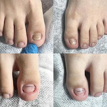 сапоги керза: Маникюр • Педикюр • Подология Профессиональный уход за руками и — 1