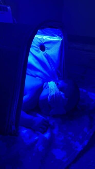 прогулочные коляски cam: Сдается лампа от желтухи. Сутка стоит 200с . Г.Кара-Балта. Есть — 2