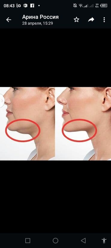 Косметология, Ботокс, Биоревитализация, Ботулинотерапия, С выездом на дом, Консультация, Гипоаллергенные материалы