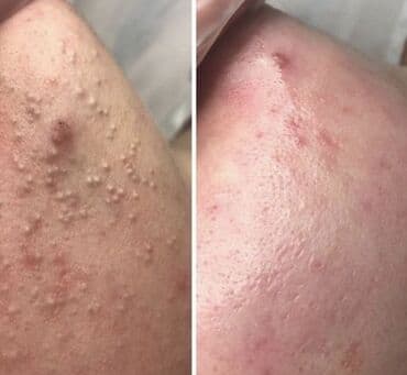 косметолог кант: Косметология, Чистка кожи, Консультация, Требуются модели, Сертифицированный косметолог — 8