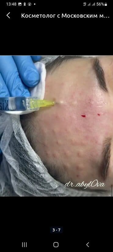 сколько стоит обучение на маникюр: Косметология, Биоревитализация, Ботулинотерапия, Сертифицированный косметолог, Гипоаллергенные материалы, Консультация — 12