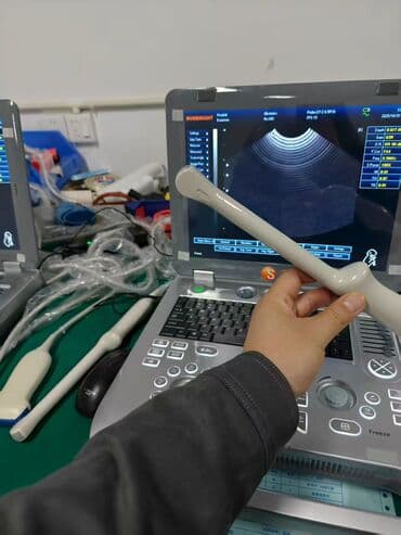 Срочно продаю Новый Портативный УЗИ аппарат 3D аппарат SUNBRIGHT с — 3