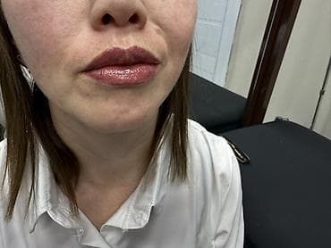 пигментные пятна: Услуга: перманентный макияж (татуаж) губ - Техника — 3
