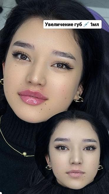 губа на машину: Косметология, Увеличение губ, Требуются модели — 1