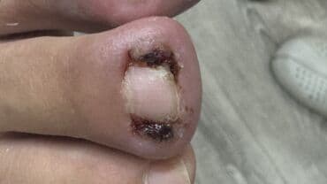 арендовать дом: Выравнивание, Услуги подолога, С выездом на дом, Консультация, Одноразовые расходные материалы — 26