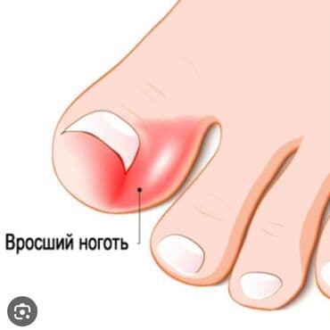 маникюр педикюр с выездом на дом: Выравнивание, Наращивание ногтей, Донаращивание ногтей, Маникюр, Педикюр, Услуги подолога, С выездом на дом, Консультация, Одноразовые расходные материалы — 10