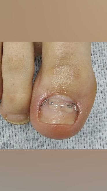 сколько стоит обучение на мастера маникюра: Коррекция вросших ногтей, Маникюр, Педикюр, Услуги подолога, Консультация, Одноразовые расходные материалы — 8