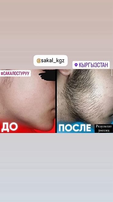 Витамины E, Для роста волос, Для мужчин, Турция, Жидкость
