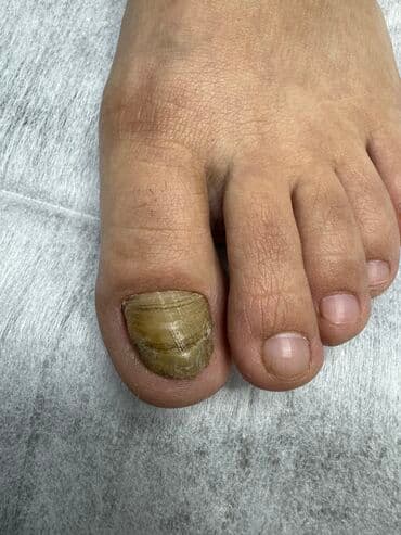 самый лучший эндокринолог рядом просп жибек жолу бишкек: Наращивание ногтей, Укрепление ногтей, Ремонт сломаных ногтей, Маникюр, Педикюр, С выездом на дом, Консультация, Одноразовые расходные материалы — 8