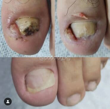 сколько стоит обучение на мастера маникюра: Выравнивание, Наращивание ногтей, Донаращивание ногтей, Маникюр, Педикюр, Услуги подолога, Консультация — 4