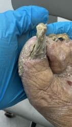 на дом керек: Услуги подолога, С выездом на дом, Консультация, Одноразовые расходные материалы — 16