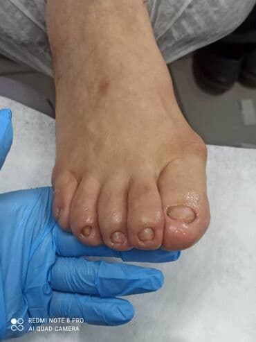 сколько стоит обучение на мастера маникюра: Выравнивание, Наращивание ногтей, Донаращивание ногтей, Маникюр, Педикюр, Услуги подолога, Консультация, Одноразовые расходные материалы — 4