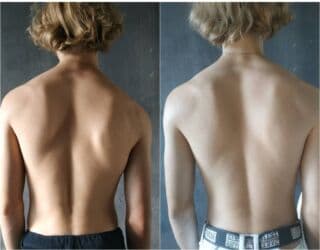 массаж швз: Массаж | Лимфодренажный массаж | Остеохондроз, Протрузия, Кифос, лордоз | С выездом на дом, Консультация — 6