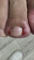 арендовать дом: Выравнивание, Услуги подолога, С выездом на дом, Консультация, Одноразовые расходные материалы — 27