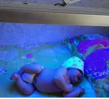 аренда лампа для лечения желтухи новорожденных: Фототерапия на дому .сдаю в аренду новые медицинские лампы от желтухи — 3