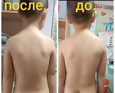 Массаж: Массаж | Детский массаж | Сутулость, нарушение осанки — 2