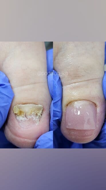 сколько стоит обучение на мастера маникюра: Протезирование ногтей 
создаём красоту на долгое время!
По записи — 1