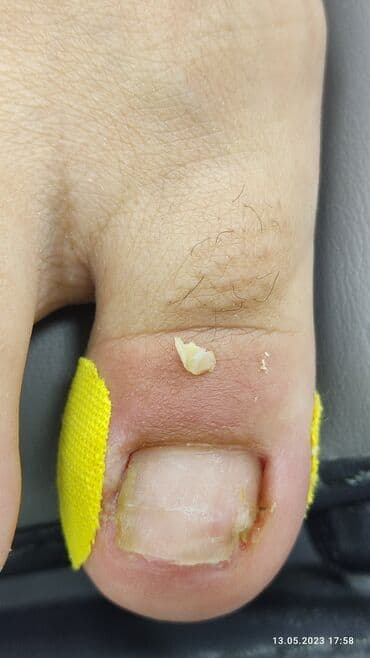 сколько стоит обучение на мастера маникюра: Коррекция вросших ногтей, Маникюр, Педикюр, Услуги подолога, Консультация, Одноразовые расходные материалы — 4