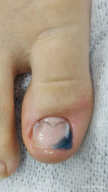 сколько стоит обучение на мастера маникюра: Коррекция вросших ногтей, Маникюр, Педикюр, Услуги подолога, Консультация, Одноразовые расходные материалы — 13