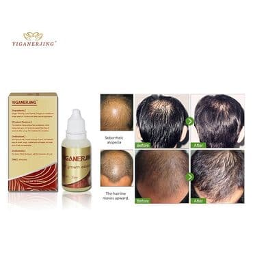 личный кабинет эрсаг кыргызстан: Средство против выпадения и для восстановления волос для мужчин и — 2