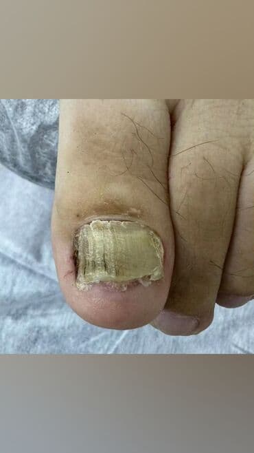 сколько стоит обучение на мастера маникюра: Коррекция вросших ногтей, Маникюр, Педикюр, Услуги подолога, Консультация, Одноразовые расходные материалы — 8