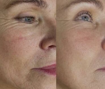 медицинский массаж курсы: Косметология, Демодекоз, Контурное моделирование, Лечение угревой болезни, Консультация, Гипоаллергенные материалы, Сертифицированный косметолог — 1