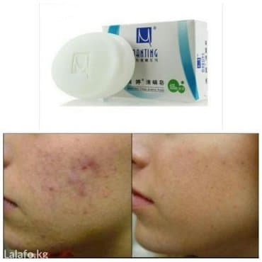 Данное мыло «Мантинг» («Manting») особенно эффективно при уничтожении lalafo.kg да Данное мыло «Мантинг» («Manting») особенно эффективно при уничтожении