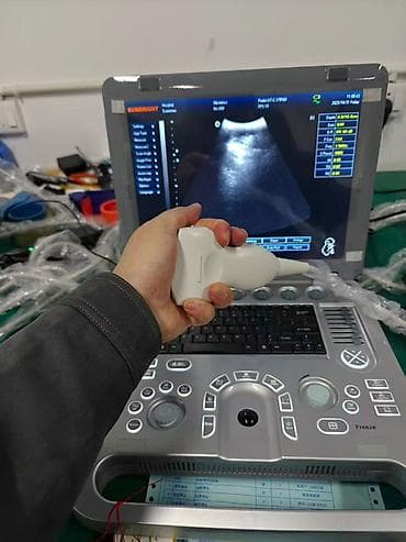 Ингаляторы, небулайзеры: Портативный ультразвуковой аппарат SUNBRIGHT (ноутбучный форм‑фактор) — 9