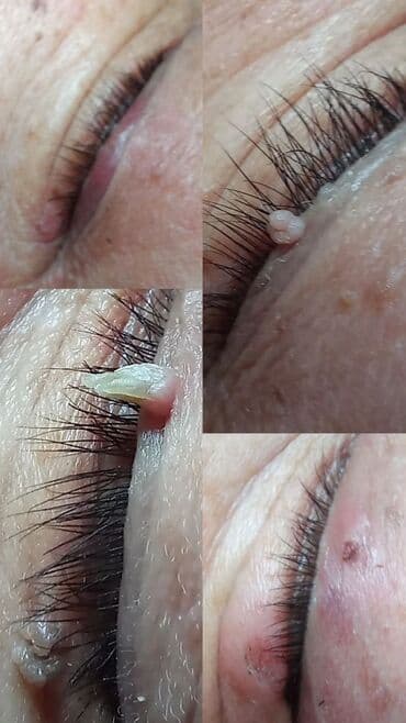 самый лучший эндокринолог рядом просп жибек жолу бишкек: Косметология, Контурное моделирование, Лечение угревой болезни, Маски, Консультация, Гипоаллергенные материалы, Сертифицированный косметолог — 7